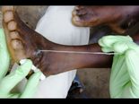 மனித இனத்தை உலுக்கும் கொடூரமான நோய்கள் 