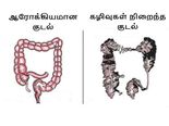 உங்கள் குடலை சுத்தம் செய்து புத்துயிர் பெற வைக்கும் 4 ஸ்டெப் ஃபார்முலா!