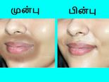 வாயைச் சுற்றி அசிங்கமாக இருக்கும் கருமையைப் போக்கும் வழிகள்!