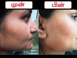 பெண்களே! முகத்தில் வளரும் முடியை எளிதில் நீக்க வேண்டுமா? அப்ப இத செய்யுங்க...