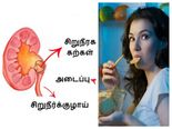 கிட்னியில் கற்கள் உருவாக காரணமாக இருக்கும் உணவுகள் இவைதான் தெரியுமா...?