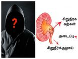 இவற்றையெல்லாம் செய்வதால் தான் உங்கள் கிட்னி சீக்கிரமாகவே சிதைவடைந்து விடுகிறது...!