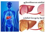 கல்லீரல் கொழுப்பை உடனடியாக வெளியேற்ற கூடிய முன்னோர்களின் ஆயுர்வேத முறைகள்..! 