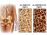 எலும்புகளின் அடர்த்தியை அதிகரிக்க வேண்டுமா? இதோ சில எளிய வழிகள்!