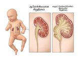 குழந்தைகளின் வயிற்றுப் பகுதி வீக்கி இருந்தா, அதுக்கு இந்த பிரச்சனை தான் காரணம்.. 