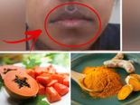 உங்க வாயை சுத்தி அசிங்கமா கருப்பா இருக்கா? இந்த வழிகளை ட்ரை பண்ணுங்க...