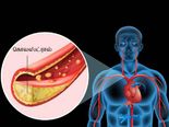 இந்த இடங்களில் வலி இருந்தால் உங்க உடலில் அளவுக்கு அதிகமாக கொலஸ்ட்ரால் இருக்குனு அர்த்தமாம்... உஷார்! 