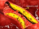உங்களுக்கு மாரடைப்பை ஏற்படுத்தும் கொலஸ்ட்ரால் அளவை ஈஸியா குறைக்க...இந்த பானங்கள நீங்க குடிக்கணுமாம்! 