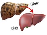 Liver Detox Tips: இரண்டே வாரத்தில் கல்லீரலில் உள்ள அழுக்கை வெளியேற்ற வேண்டுமா? அப்ப இதுல ஒன்ன தினமும் குடிங்க!