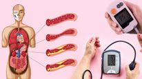 உங்க கால் & கிட்னி உட்பட 6 பாகங்களில் இந்த அறிகுறிகள் இருந்தா? இரத்தத்துல சர்க்கரை அதிகமா இருக்காம்!