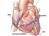 Coronary Calcium Distribution
