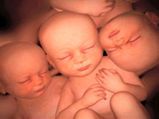 Aussie Grandma Gives Birth To Identical Triplets