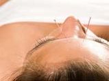 Acupuncture May Treat Women With Fertility Problems