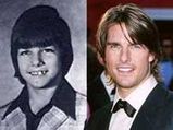 Tom Cruise Bagged Ice As A Child