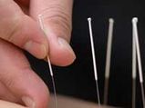 Acupuncture May Help To Banish The Blues