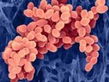 Antimicrobial Swipe And MRSA Superbug