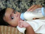 Bottle Feeding May Result To Obesity In Babies