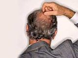 Hair Growth On Bald Spots Now Possible
