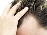 Men Hair Care Tips To Avoid Baldness