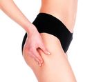 6 Effective Exercises To Treat Cellulite