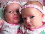 Why Do Most Celebrities Have Twin Babies?