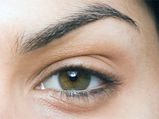 Home Remedies For Red Itchy Eyes