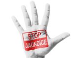 10 Ways To Prevent Jaundice