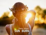 What You Need To Know About Sunburn