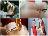 7 Bizarre Healing Treatments
