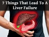 7 Things That Lead To A Liver Failure