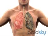 World Health Day: Simple Steps To Keep Your Lungs Healthy