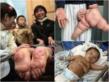 Unbelievable Genetic Accidents That Will Shock You
