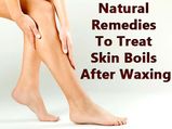 Natural Remedies To Treat Skin Boils After Waxing