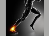 Causes And Treatment Of Achilles Tendon Rupture