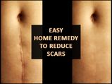 Try This Powerful Home Remedy To Reduce Injury Scars!