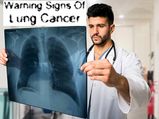 Warning Signs Of Lung Cancer You Should Never Ignore
