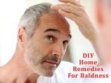 DIY Home Remedies For Baldness