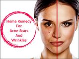 This Secret Home Remedy Reduces Acne Scars And Wrinkles, In A Week!
