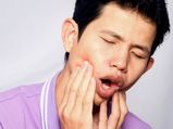 Remedies For Itchy Gums