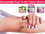 Homemade Pack To Get Fairer Elbows Using Lemon, Baking Soda & Rose Water