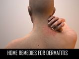 Home Remedies For Dermatitis