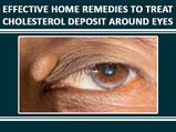 Effective Home Remedies To Treat Cholesterol Deposit Around Eyes