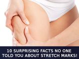 10 Surprising Facts No One Told You About Stretch Marks!