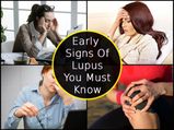 7 Early Signs Of Lupus You Should Know About