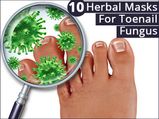10 Herbal Masks For Toenail Fungus