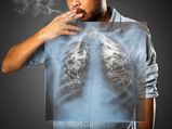 Simple Ways To Avoid Getting Lung Cancer