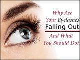 Why Are Your Eyelashes Falling Out & What You Should Do?