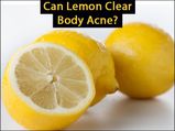 Can Lemon Clear Body Acne?