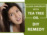 5 DIY Tea Tree Oil Remedies For 99% Dandruff Clearance!