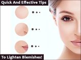 Quick & Effective Tips To Lighten Blemishes!
